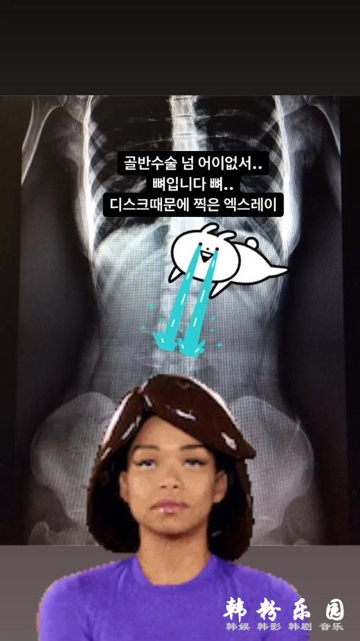 i发布X光照回击整形传闻  韩美女漫画家Yaongy